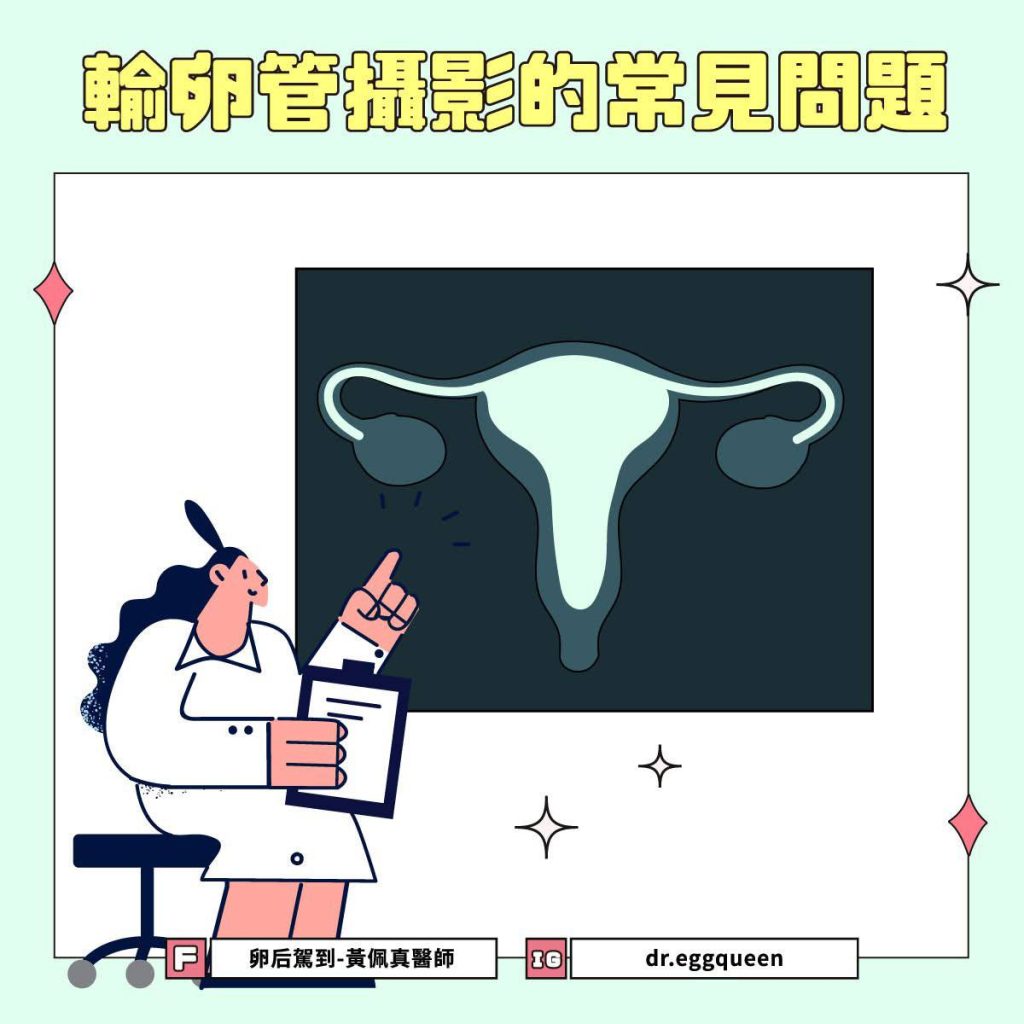 輸卵管攝影會痛嗎？黃佩真醫師解答5大HSG常見問題