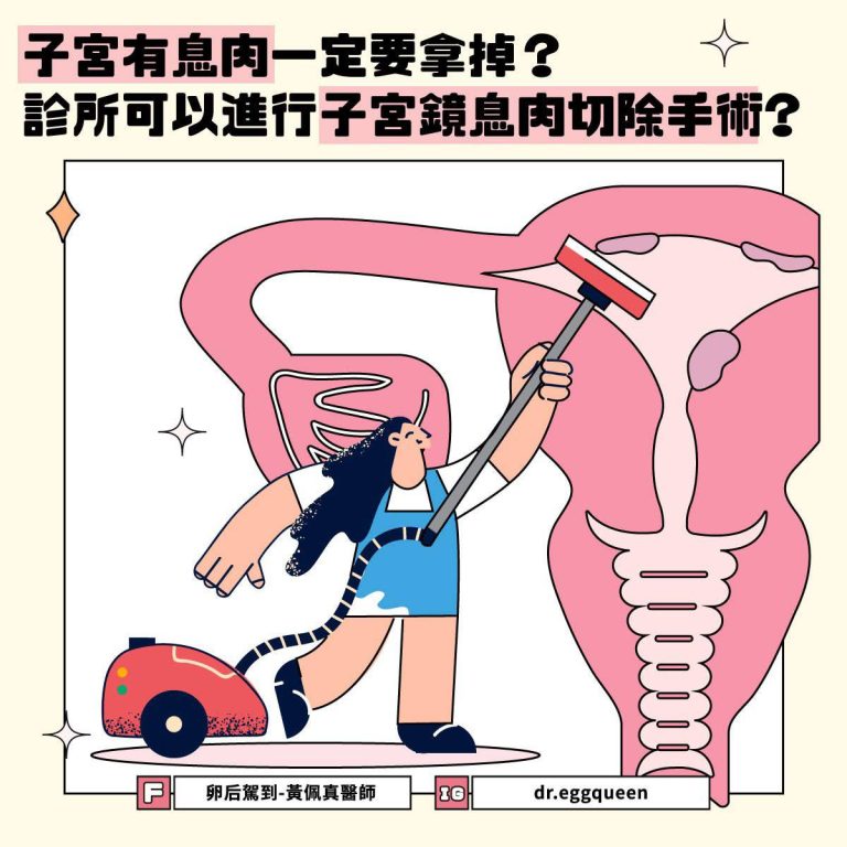 子宮有息肉一定要拿掉嗎？黃佩真醫師解說子宮鏡息肉切除手術