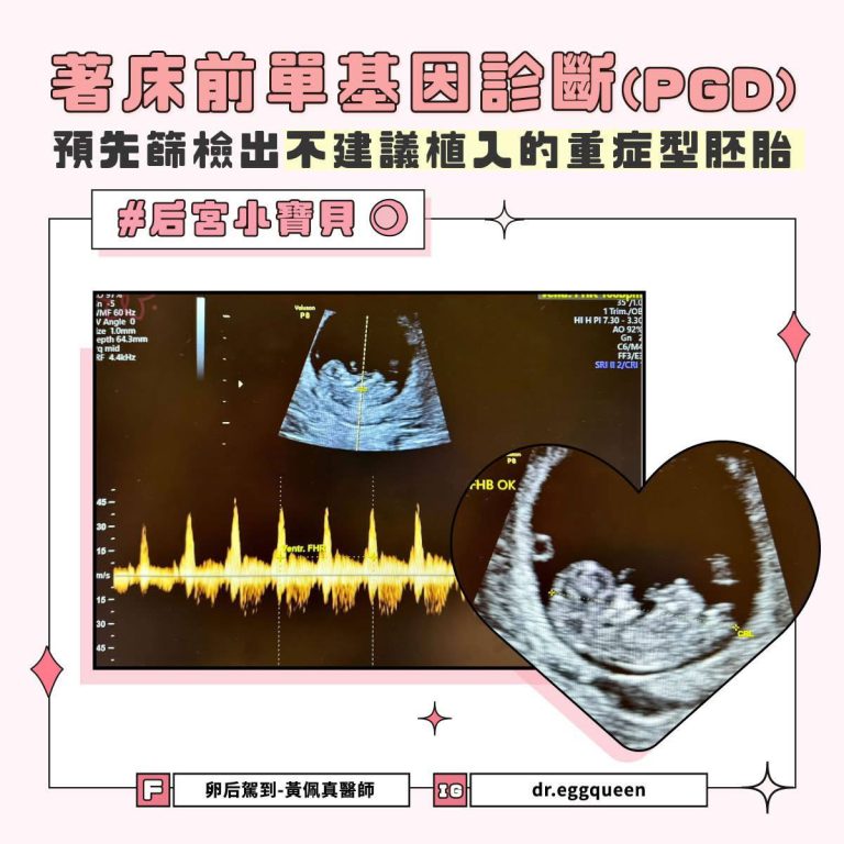 著床前單基因診斷(PGD)能做什麼？黃佩真醫師以海洋性貧血為例說明